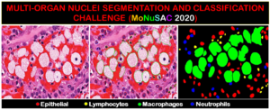 MoNuSAC 2020: Nuclei Segmentation and Classification