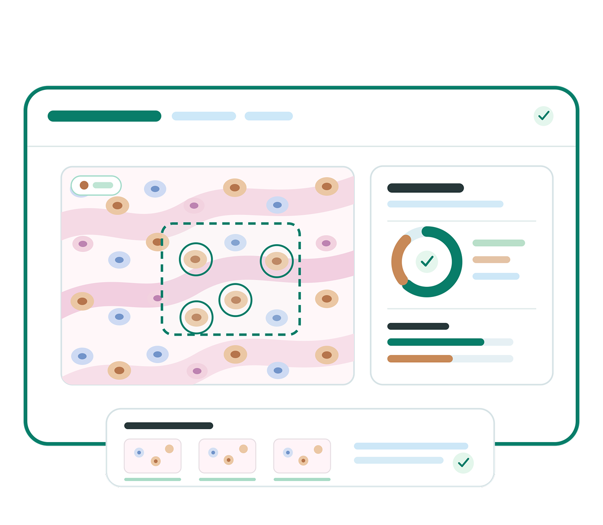Digital pathology interface showing biomarker analysis, annotated tissue regions, cell counts and quantitative summary charts