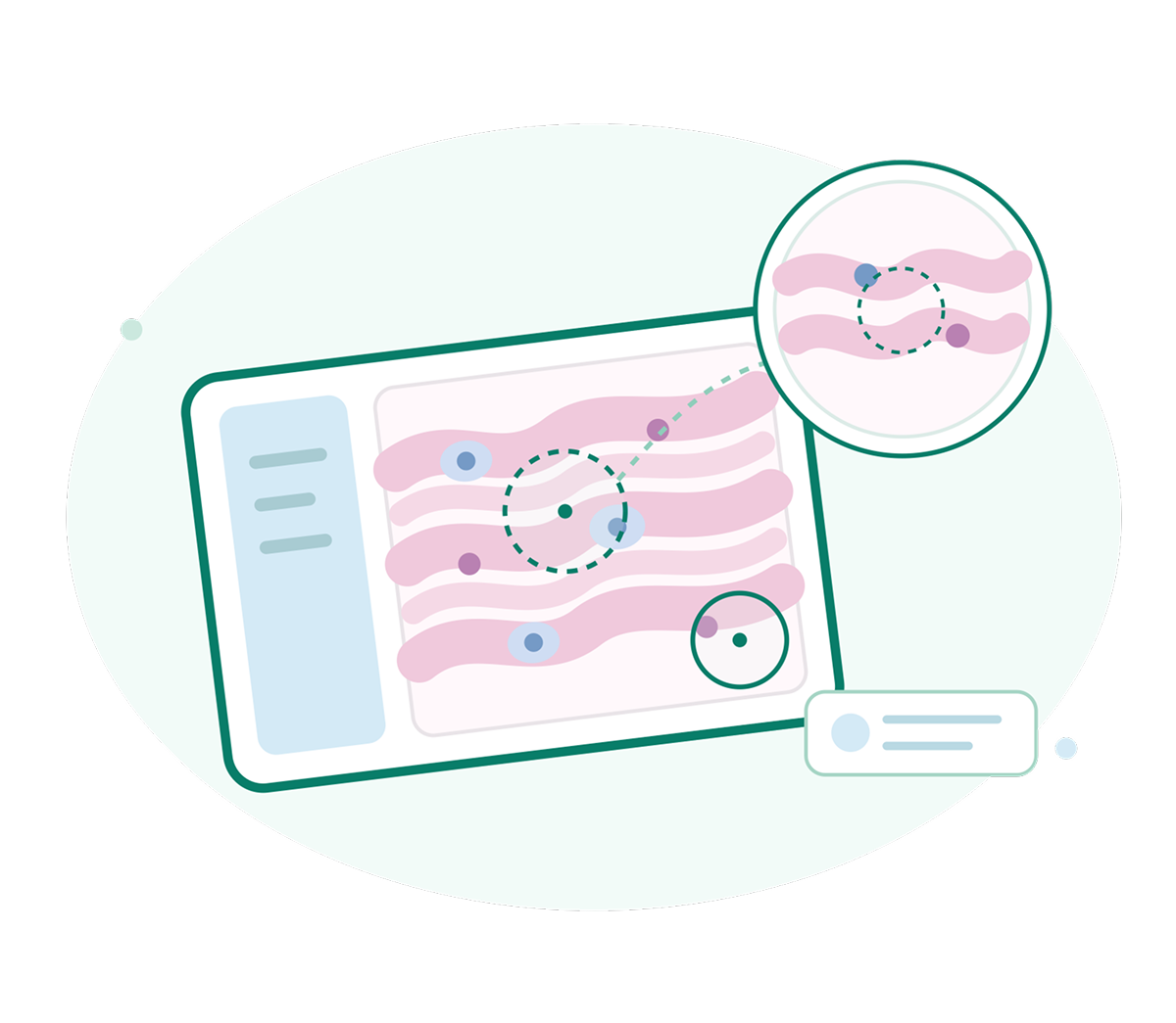 AI pathology image analysis of tissue sample on digital slide.