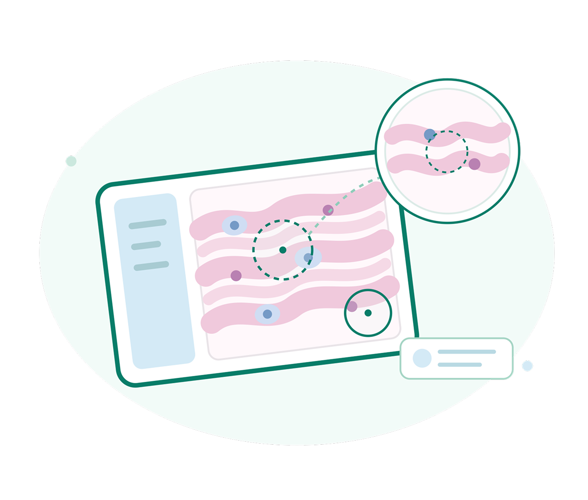 Illustration of a genetic test report with pink DNA strands, highlighted markers, and a magnified detail, conveying a calm, clinical look at genetic analysis.